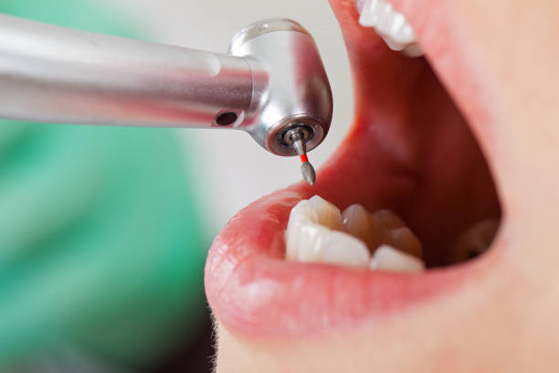 Best Urgent Tooth Repair  in Union City, NJ